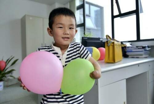 Xiaocheng, 6 anos, perdeu parte da mão esquerda em um acidente de carro quando tinha 4 anos. (Foto: Reprodução)