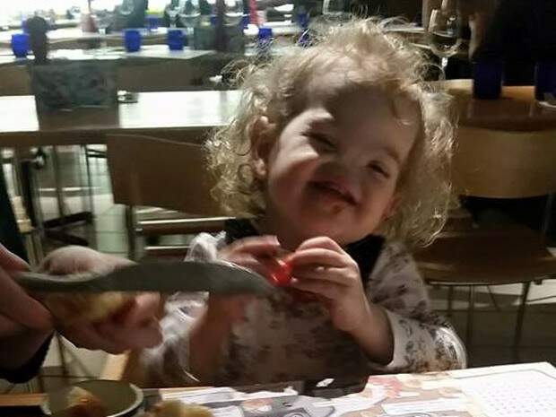 Tessa foi fotografada por seu pai antes de se submeter à cirurgia para implante de prótese no nariz. Crédito: Reprodução