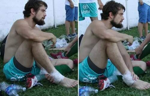 Rafael Cardoso torceu o pé no último fim de semana. (Foto: Reprodução)