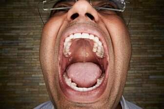 Vijay Kumar, de 27 anos, é a pessoa viva com mais dentes na boca: 37 (Foto: Reprodução)