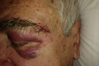 Médico está com hematomas pelo corpo e um corte no supercílio. Foto: Reprodução