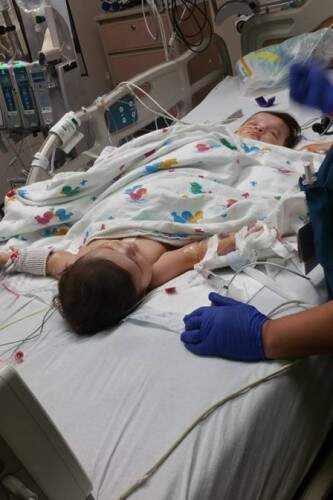 Ximena e Scarlett Hernandez-Torres se recuperam no hospital Driscoll Children, no Texas (EUA). (Crédito: Reprodução)