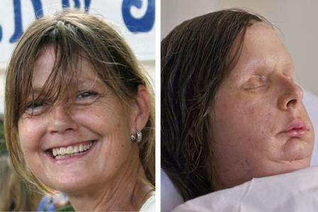 Charla Nash antes do acidente e após a cirurgia, em 2011. (Foto: Reprodução)