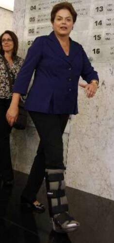 Dilma sofreu uma lesão nos ligamentos  e teve que usar bota ortopédica em 2010.