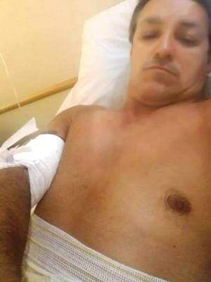 Renato Souza sofreu ferimentos graves que atingiram a sua musculatura e segue internado em hospital do litoral paulista. (Crédito: Reprodução)