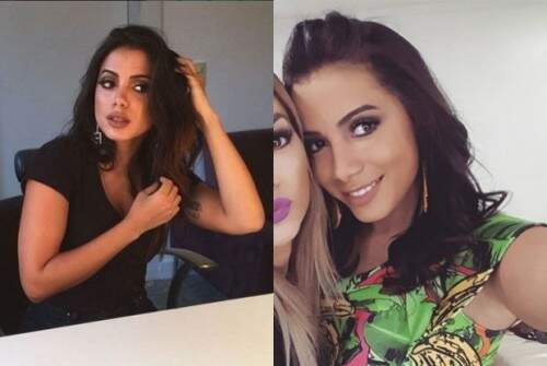 Antes e depois: Anitta aparece com lábios mais grossos. (Foto: Reprodução) 