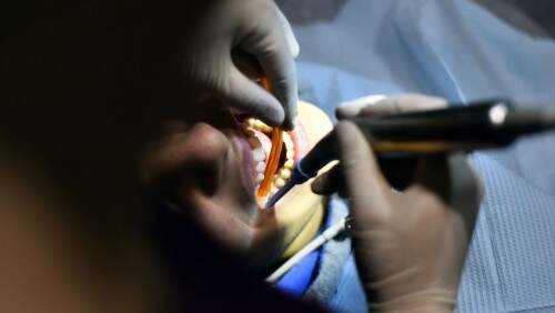 Dentista holandês mutilou dezenas de pacientes na França. (Foto: Reprodução)