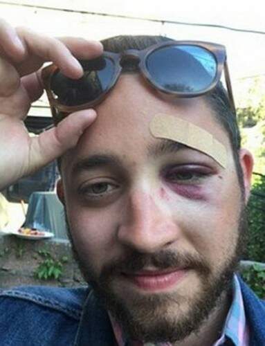 Ele chegou a ficar inconsciente por alguns minutos. (Foto: Reprodução)