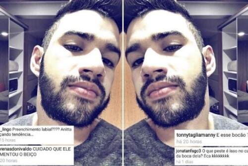 Gusttavo Lima vira piada após exibir boca com preenchimento. (Foto: Reprodução) 