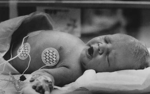 Jillian aparece em foto tirada no hospital após ser encontrada em 1984  (foto: reprodução)