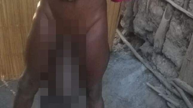 A condição só se manifestou quando ele estava entrando na puberdade. (Crédito: Reprodução)