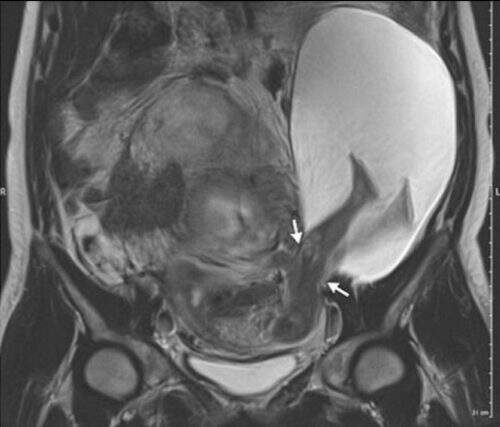Ultrassom registrou a raridade. (Foto: Reprodução)