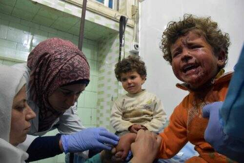Crianças feridas recebem tratamento em Aleppo; pelo menos 68 teriam morrido em ataque no sábado. (Foto: Reprodução)